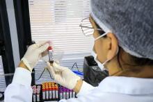 A Coordenadoria de Desenvolvimento de Pessoas (Codepe - Uepa) em parceria com a Fundação Hemopa, realiza campanha de doação de sangue na reitoria da Universidade Estadual do Pará (Uepa), nesta segunda - feira, 27, das 9 às 15h. Foto: Sidney Oliveira/Ascom Uepa.