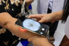 A Universidade do Estado do Pará (Uepa) sediou na manhã desta sexta-feira, 18, o mutirão de atendimento dermatológico com foco em hanseníase, promovido pela Sociedade Brasileira de Dermatologia (SBD) em parceria com a International League of Dermatological Society (ILDS). Foto: Sidney Oliveira/Ascom Uepa